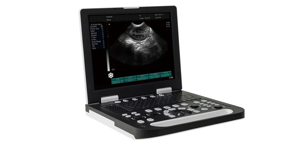 Laptop Ultrasound Machine Laptop Ultrasound Machine