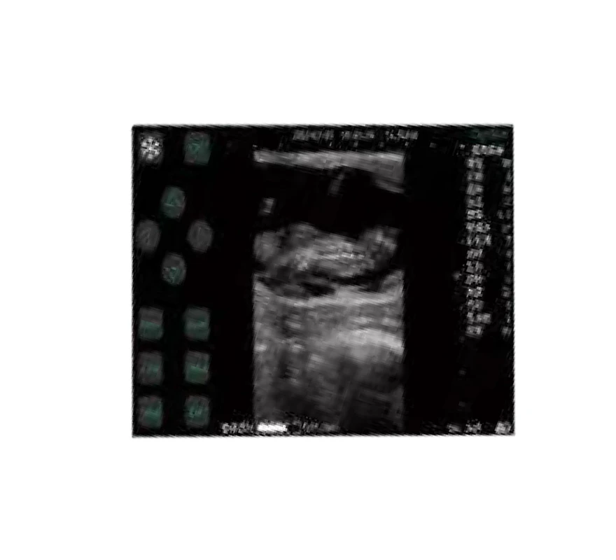 Touch Screen Veterinary Ultrasound Machine Pricelist Touch Screen Veterinary Ultrasound Machine Pricelist