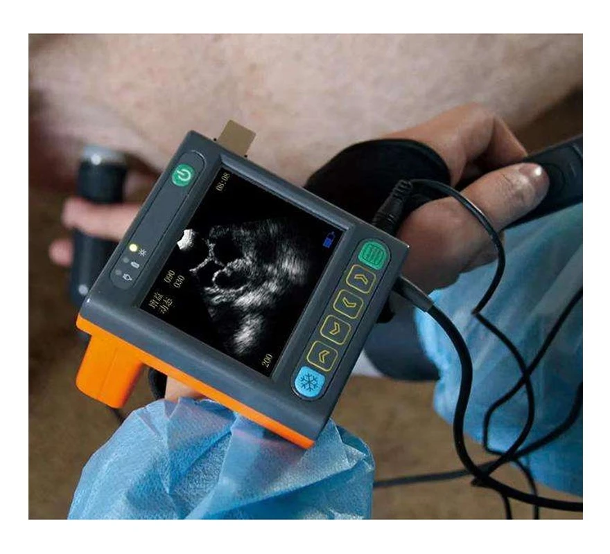 Veterinary Ultrasound with Probe Pricelist Veterinary Ultrasound with Probe Pricelist